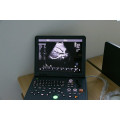 Laptop 3D &amp; 4D Ultraschallgerät Preis &amp; DAWEI DWC60 Farbdoppler